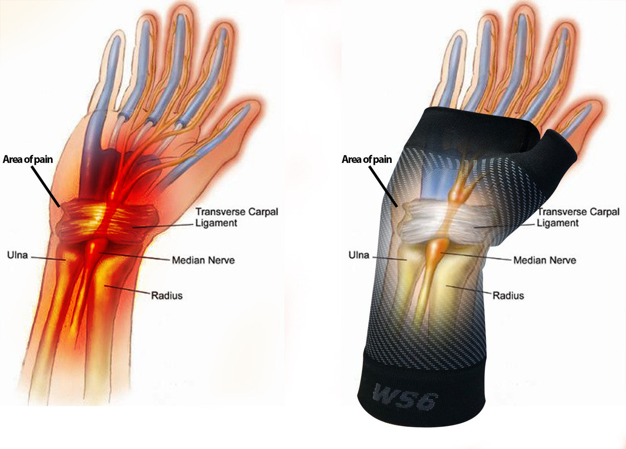 OS1st WS6 Performance Wrist Sleeve