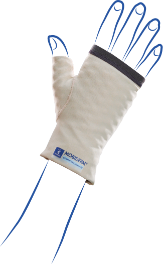 MOBIDERM Standard Mitten