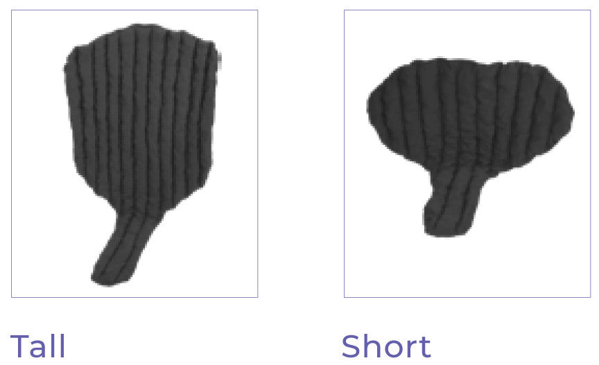 Sigvaris Chip Pads Genifit - Black – Compression Health