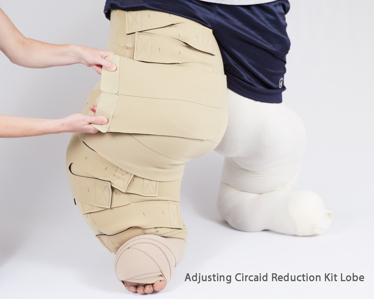 Circaid Reduction Kit Lobe